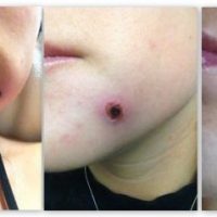 Unexpected Hospital Stay